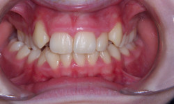 Before