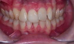 Before