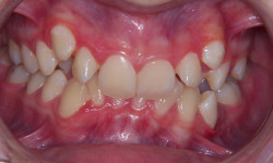 Before